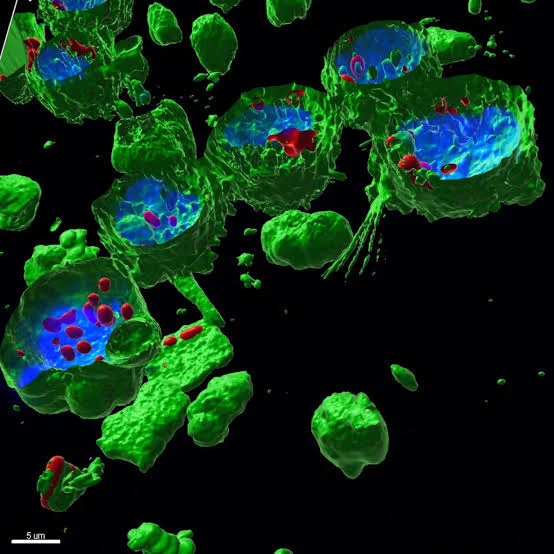 Microplastics and Cellular Damage: How Tiny Plastic Particles Could Pose a Hidden Health Risk